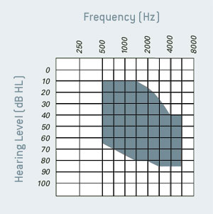 Hearing_Level Hearing_Level